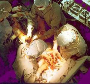 Coronary_artery_bypass_surgery