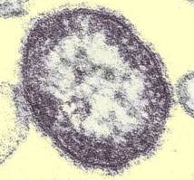 Measlesvirus2