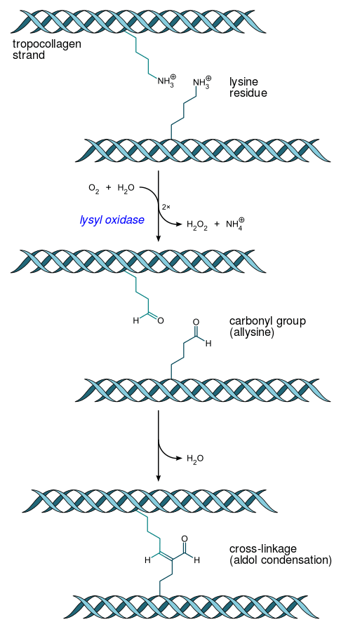 Tropocollagen_cross-linkage_lysyl_oxidase