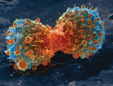 Lung_cancer_cell_during_cell_division-NIH