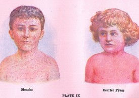 Measles-and-Scarlet-Fever-EUObserver