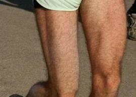 Leg_Muscle_weakness_Lead_Toxicity