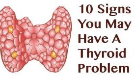 Low-thyroid-conditon